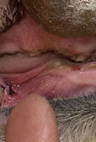 After fighting teeth removed