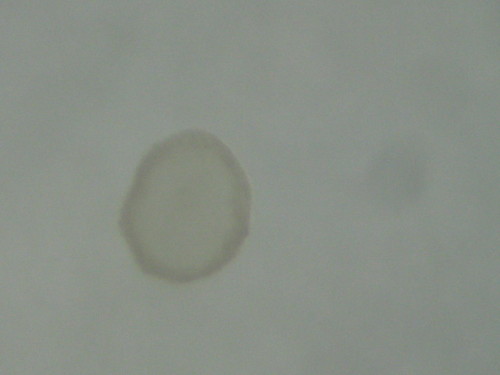 Flushed Embryo prior to transfer