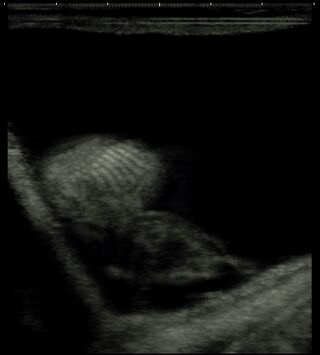 Ultrasound - Can you see the cria?
